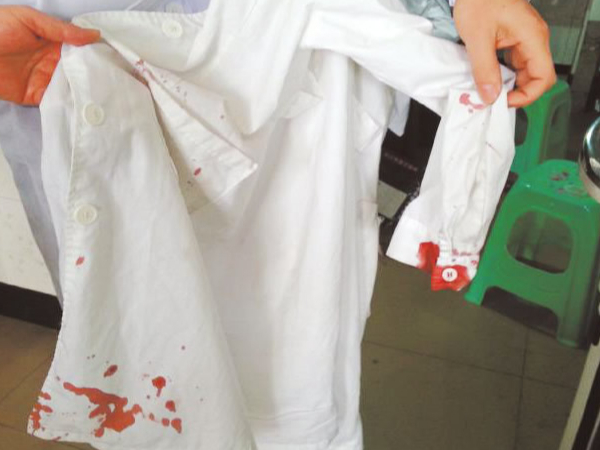 洗涤日化—酶制剂解决方案